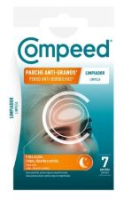 Anti-pimple Cleansing Patch 7 Pieces